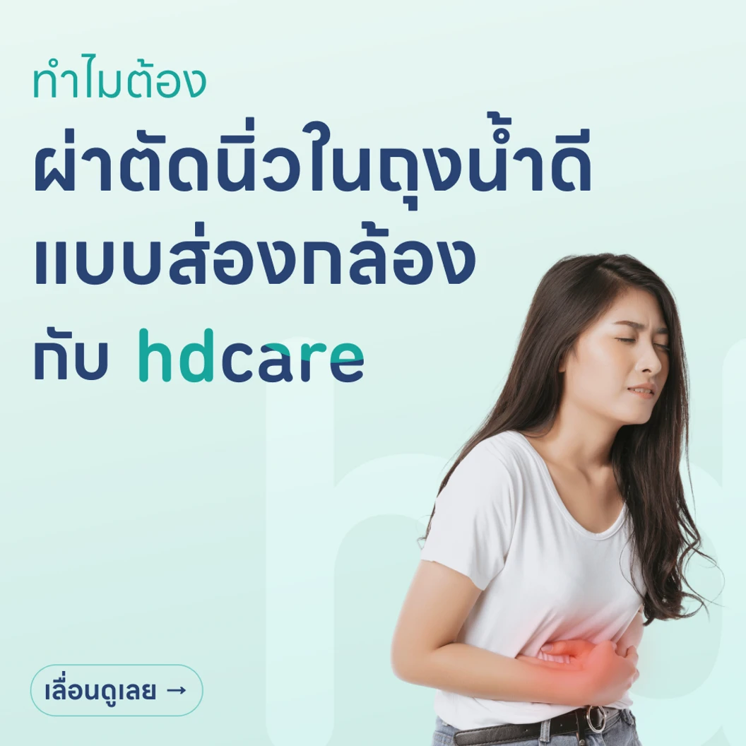 ผ่าตัดนิ่วในถุงน้ำดี (แบบส่องกล้อง)