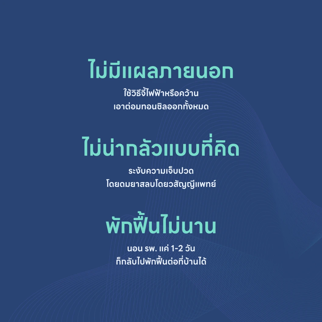 ผ่าตัดทอนซิล