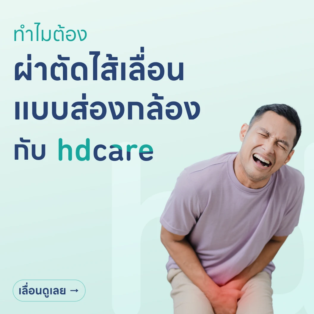 ผ่าตัดไส้เลื่อน (แบบส่องกล้อง)