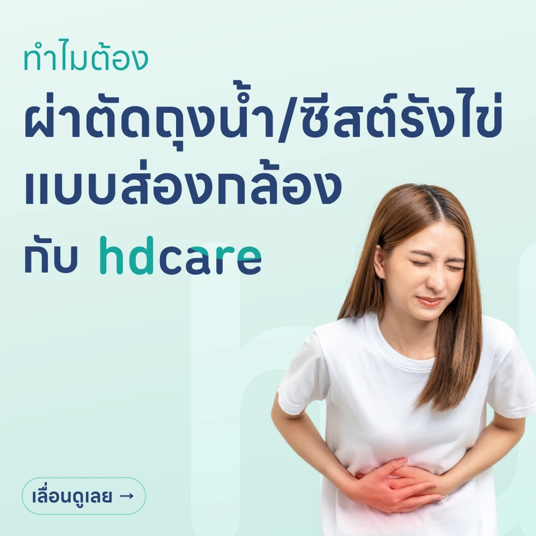 ผ่าตัดถุงน้ำหรือซีสต์รังไข่ (แบบส่องกล้อง)