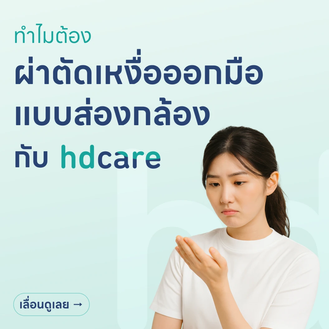 ผ่าตัดเหงื่อออกมือ