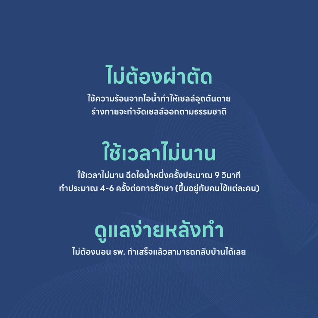 รักษาโรคต่อมลูกหมากโตด้วยไอน้ำ (Rezum)