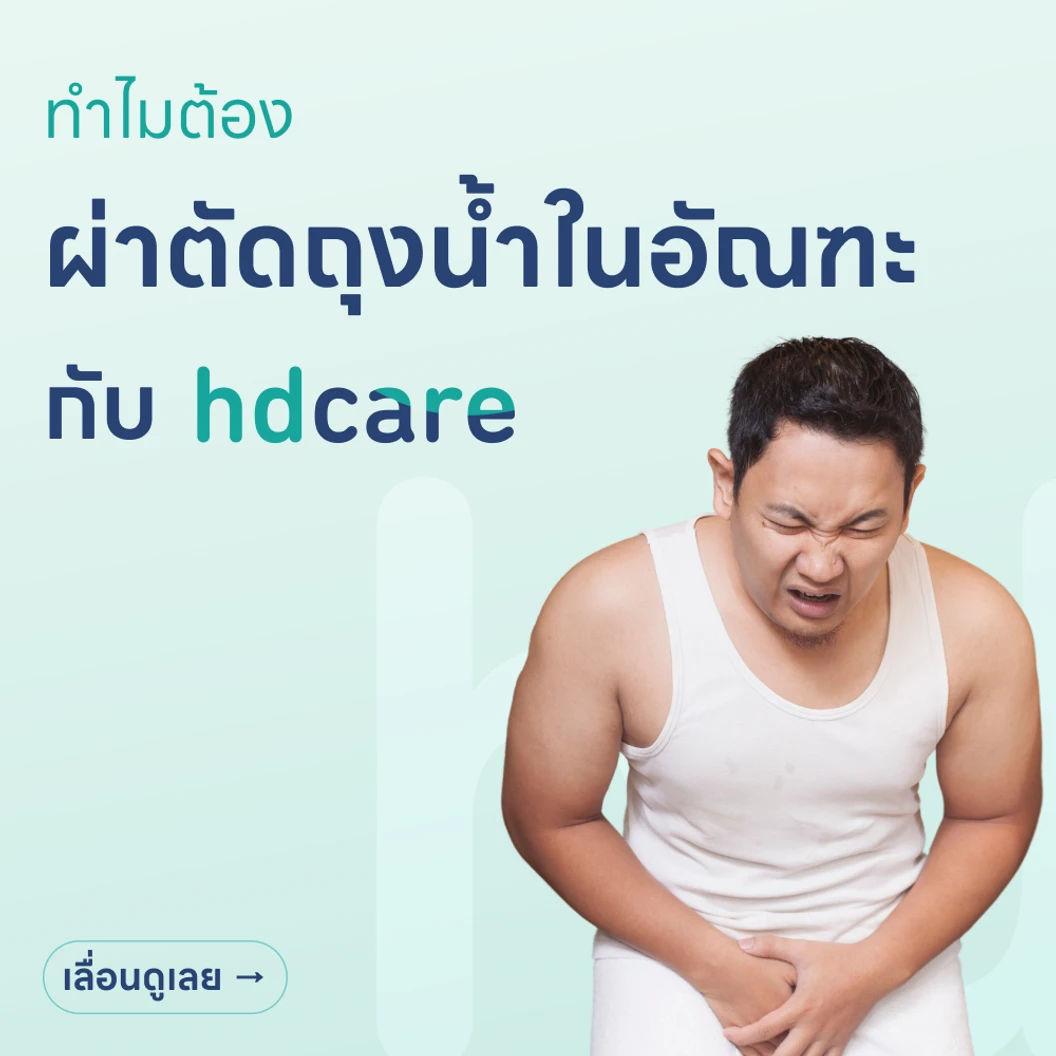 ผ่าตัดถุงน้ำในอัณฑะ