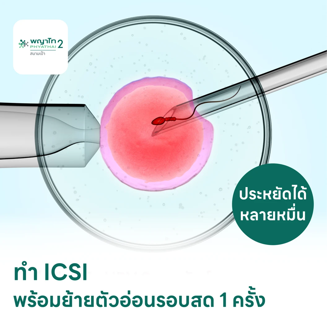 ทำ ICSI พร้อมย้ายตัวอ่อนรอบสด 1 ครั้ง