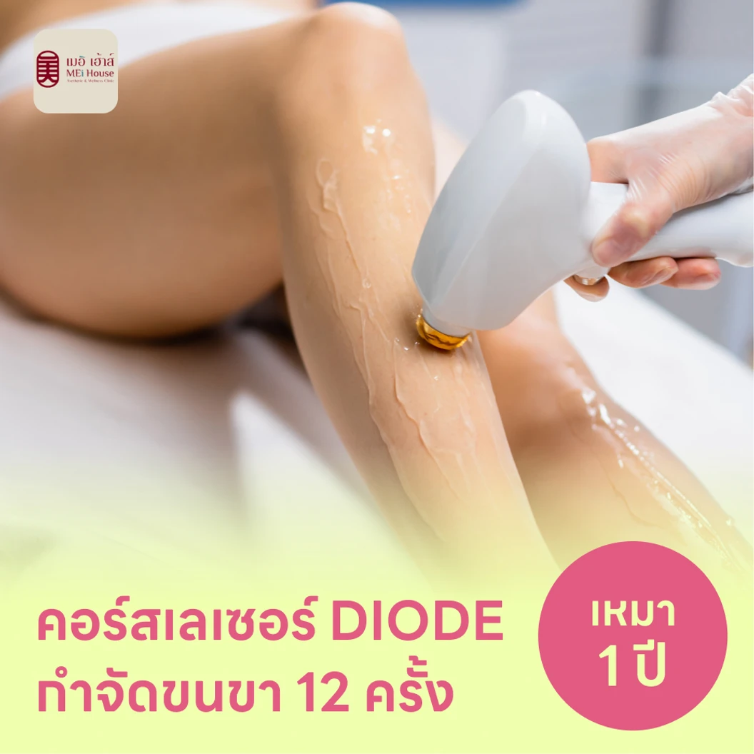 คอร์สเลเซอร์กำจัดขนทั่วขา 12 ครั้ง ด้วย Diode Laser
