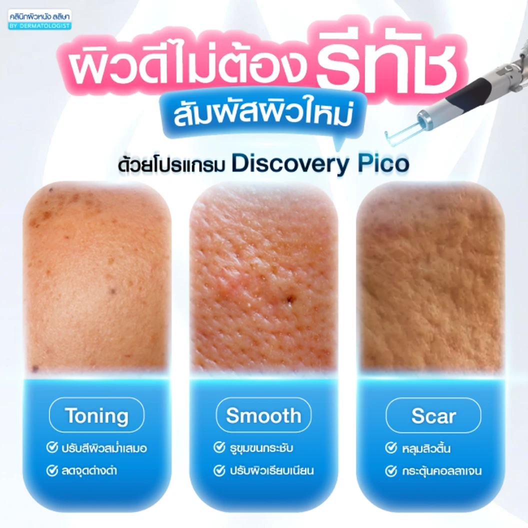 Picosecond Laser แก้ปัญหาผิวทั่วใบหน้า 1 ครั้ง จำกัด 1 ท่านต่อ 1 สิทธิ์ เท่านั้น