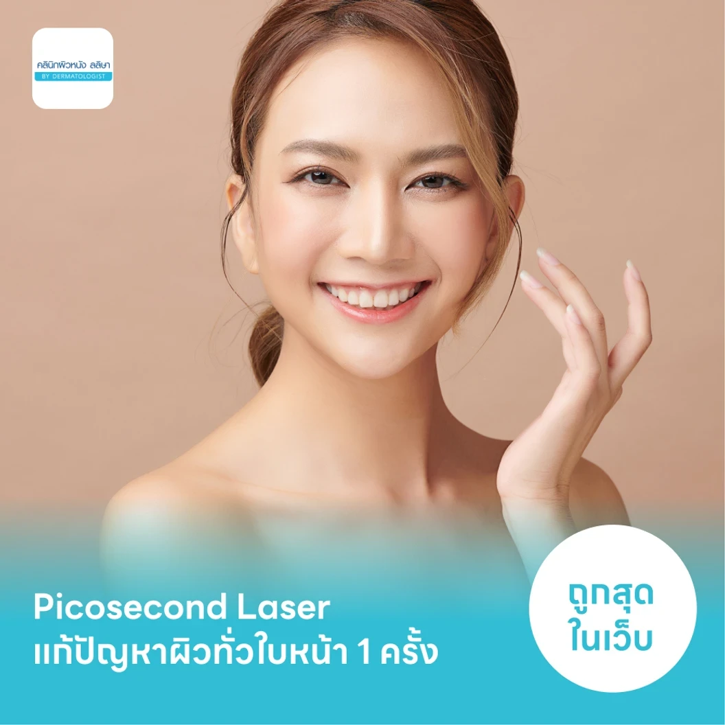 Picosecond Laser แก้ปัญหาผิวทั่วใบหน้า 1 ครั้ง จำกัด 1 ท่านต่อ 1 สิทธิ์ เท่านั้น