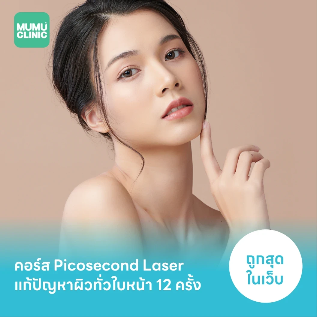 คอร์ส Picosecond Laser แก้ปัญหาผิวทั่วใบหน้า 12 ครั้ง