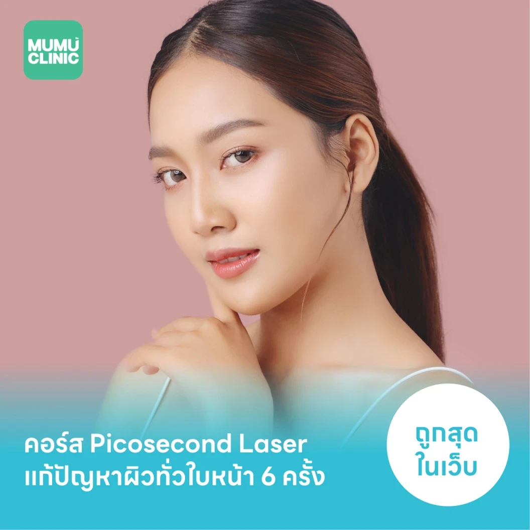 คอร์ส Picosecond Laser แก้ปัญหาผิวทั่วใบหน้า 6 ครั้ง