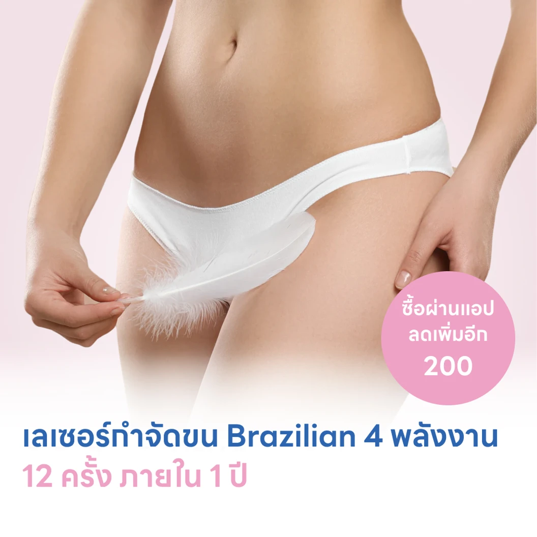 คอร์สกำจัดขน Brazilian ด้วยเลเซอร์ 4 พลังงาน เครื่องแท้ Primelase จากสเปน 12 ครั้ง ภายใน 1 ปี สำหรับผู้หญิงหรือผู้ชาย (1 สิทธิ์/ท่าน)