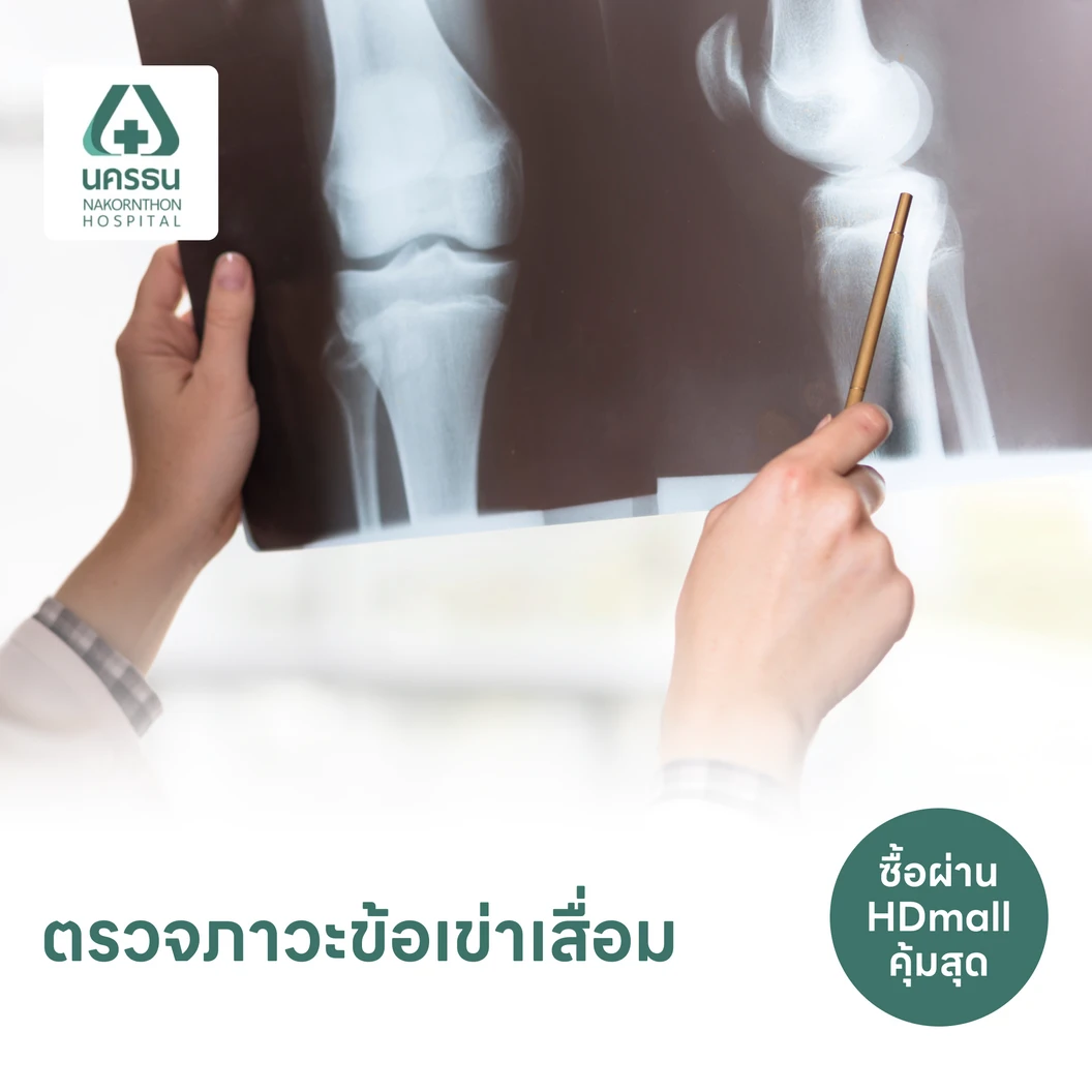 ตรวจวินิจฉัยอาการข้อเข่าเสื่อม ด้วยเครื่องเอกซ์เรย์ข้อเข่า 2 ข้าง