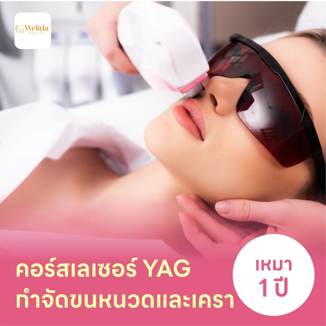 คอร์สเลเซอร์กำจัดขนหนวดและเครา 12 ครั้ง ด้วย YAG Laser