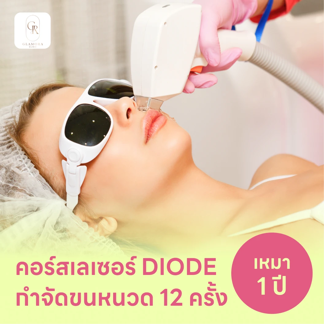 คอร์สเลเซอร์กำจัดขนหนวด 12 ครั้ง ด้วย Diode Laser