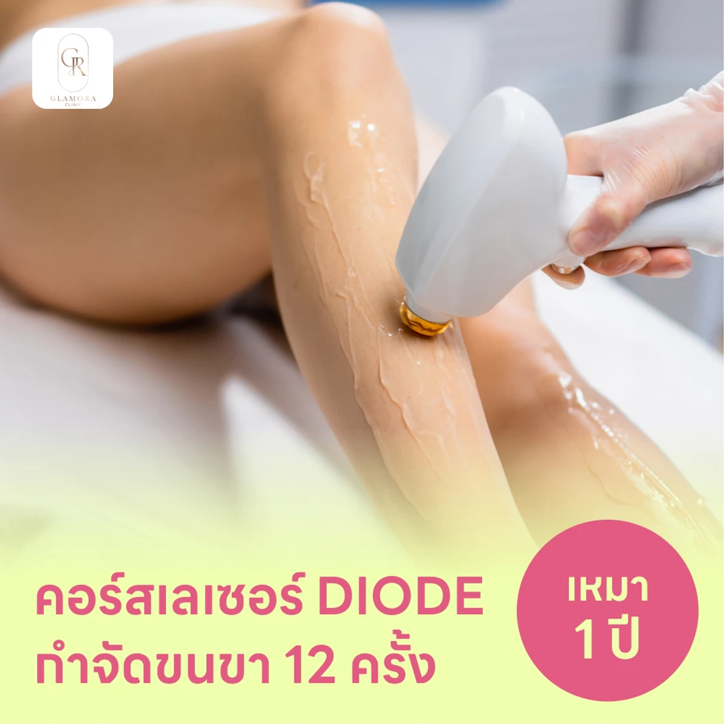 คอร์สเลเซอร์กำจัดขนทั่วขา 12 ครั้ง ด้วย Diode Laser