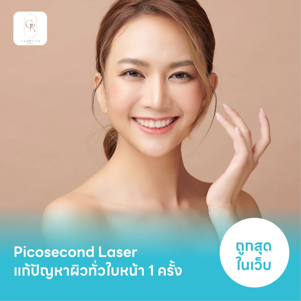 Picosecond Laser แก้ปัญหาผิวทั่วใบหน้า 1 ครั้ง จำกัด 1 ท่านต่อ 1 สิทธิ์ เท่านั้น