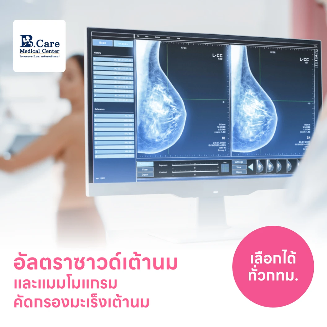 ตรวจคัดกรองมะเร็งเต้านมด้วยวิธีอัลตราซาวด์และแมมโมแกรม