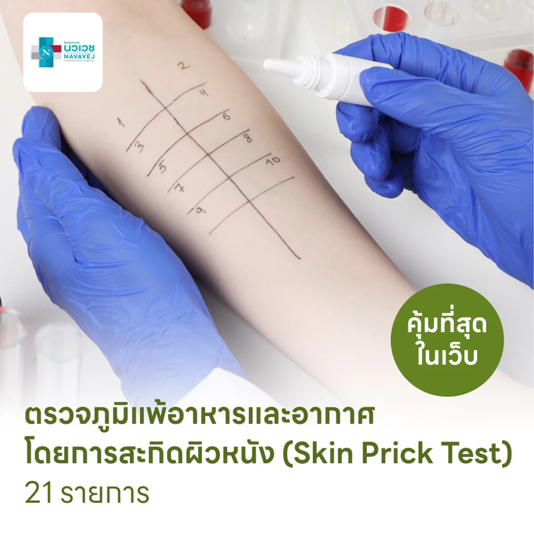 ตรวจหาสารก่อภูมิแพ้อาหารและสารก่อภูมิแพ้ในอากาศ 21 รายการ โดยการสะกิดผิวหนัง