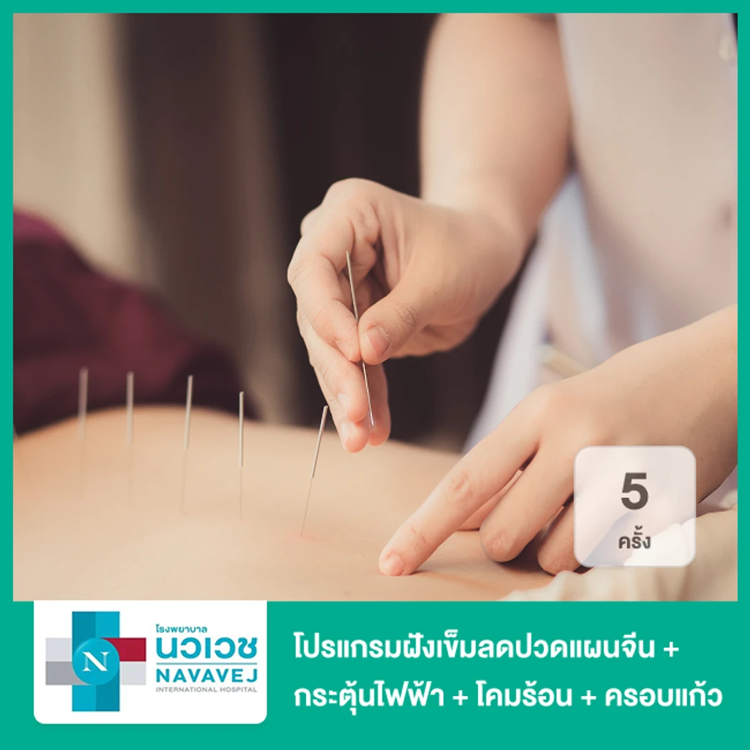 โปรแกรมฝังเข็มลดปวดแผนจีน + กระตุ้นไฟฟ้า + โคมร้อน + ครอบแก้ว 5 ครั้ง