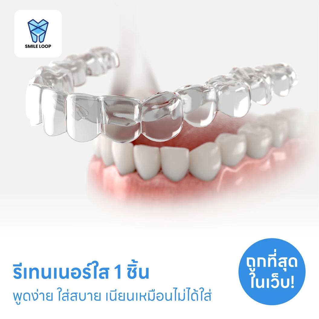 ทำรีเทนเนอร์แบบใส 1 ชิ้น