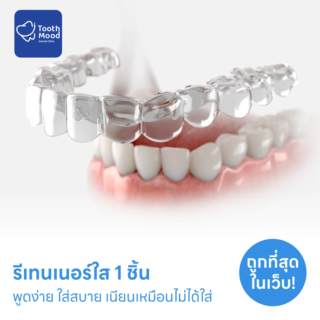 ทำรีเทนเนอร์แบบใส 1 ชิ้น