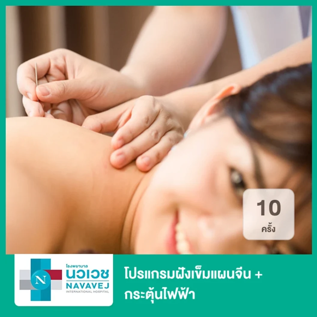 โปรแกรมฝังเข็มแผนจีน + กระตุ้นไฟฟ้า 10 ครั้ง