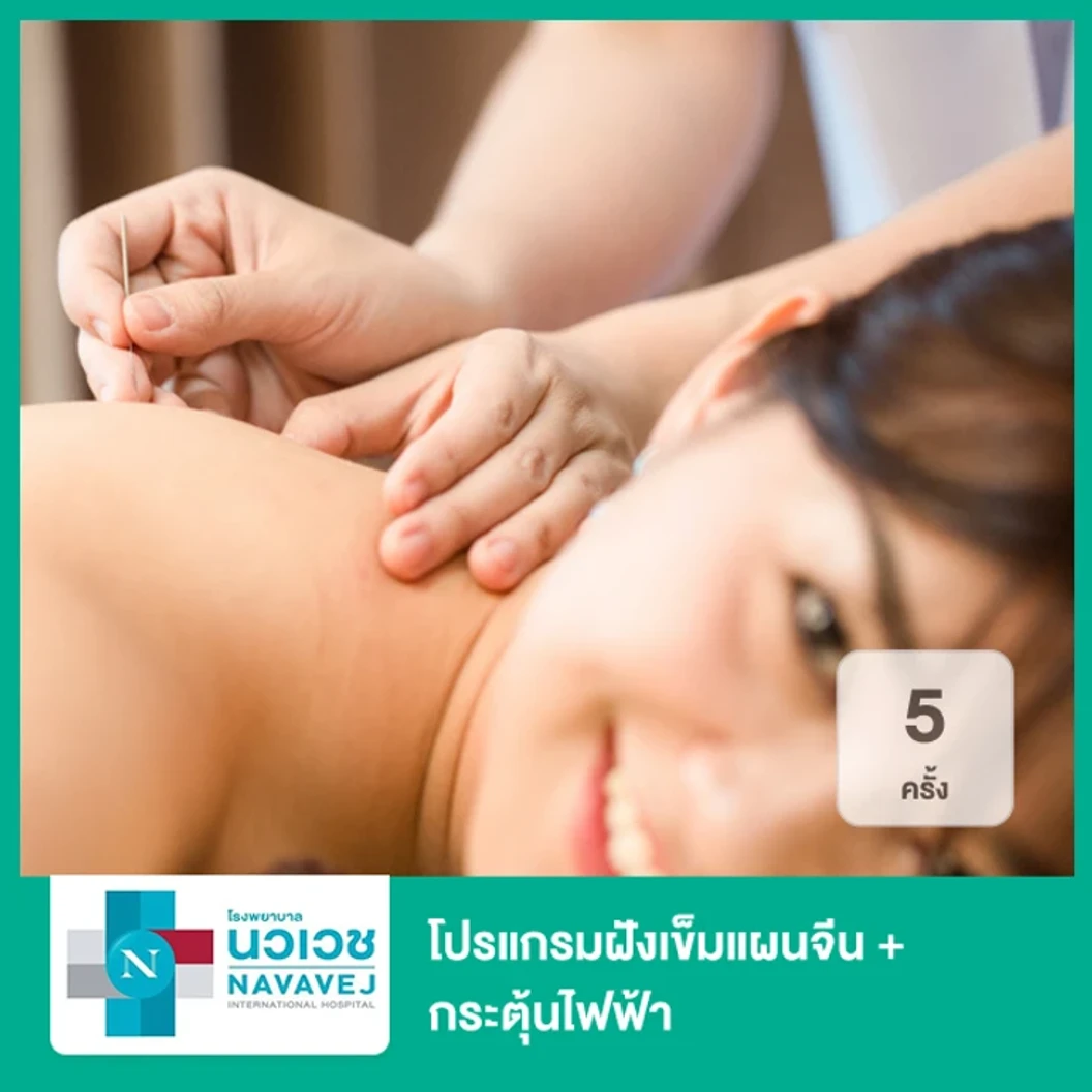 โปรแกรมฝังเข็มแผนจีน + กระตุ้นไฟฟ้า 5 ครั้ง