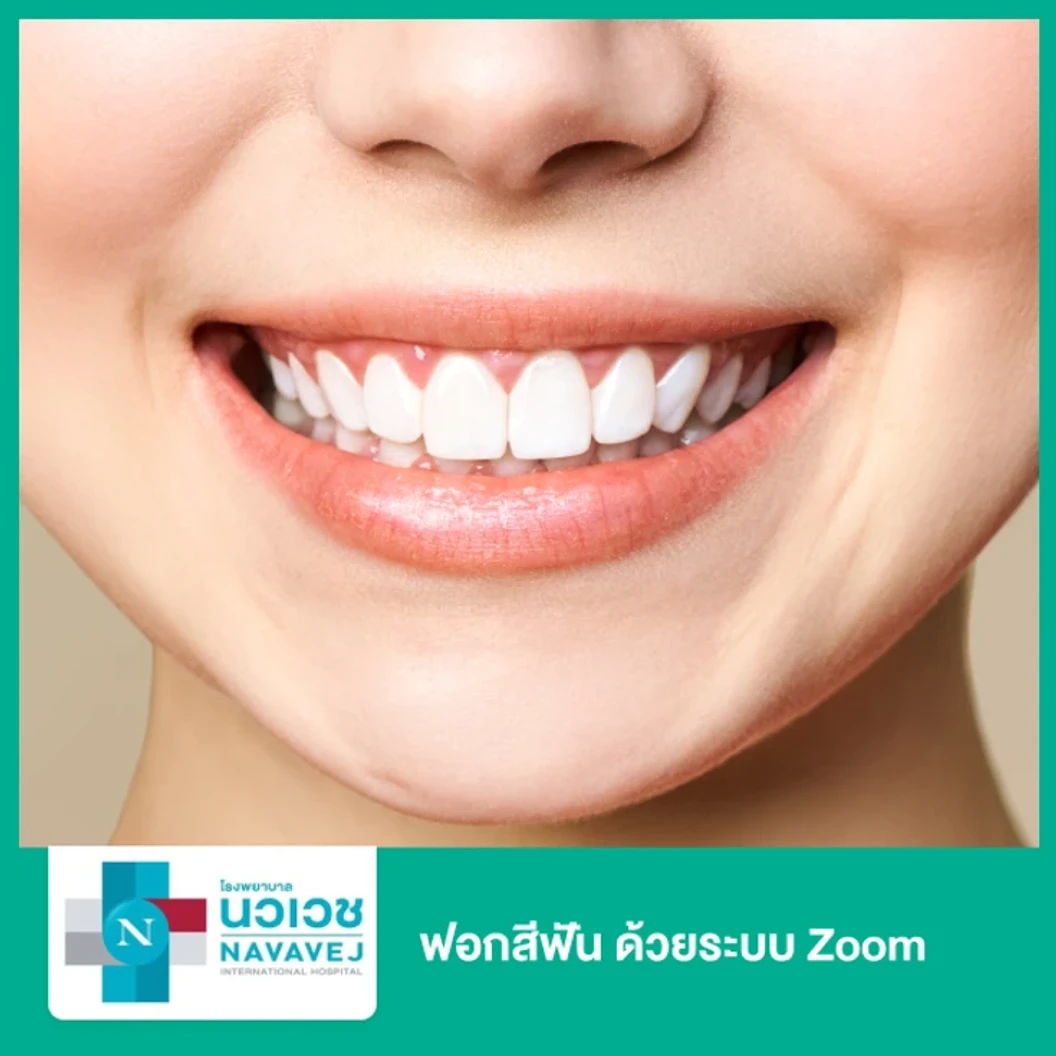 ฟอกสีฟัน ด้วยระบบ Zoom