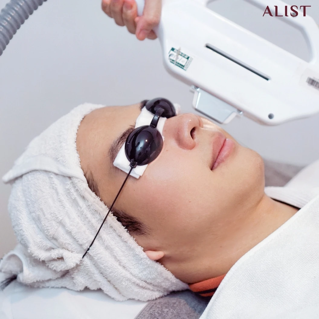 โปรแกรมลดรอยสิวหน้า (E-Light Program) 6 ขั้นตอน