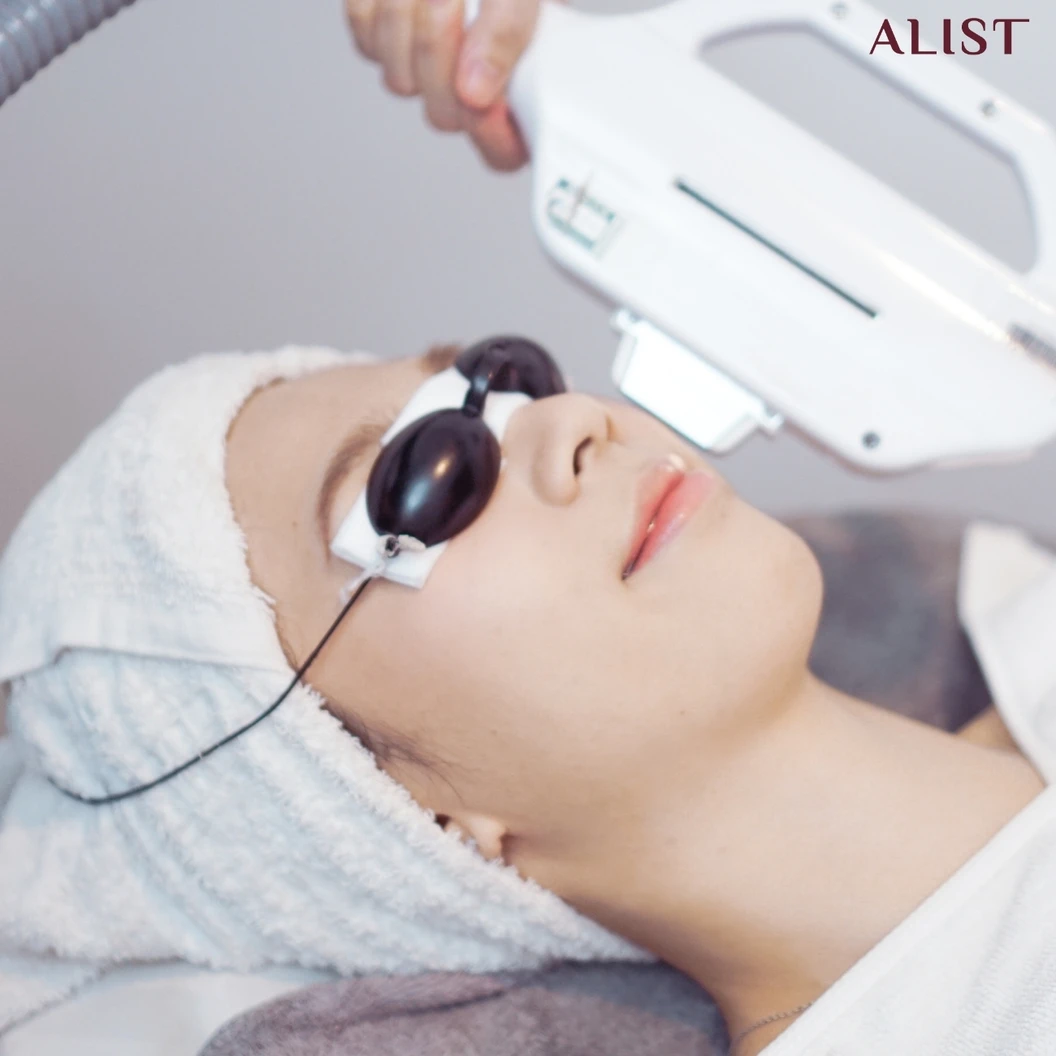 โปรแกรมลดรอยสิวหน้า (E-Light Program) 6 ขั้นตอน