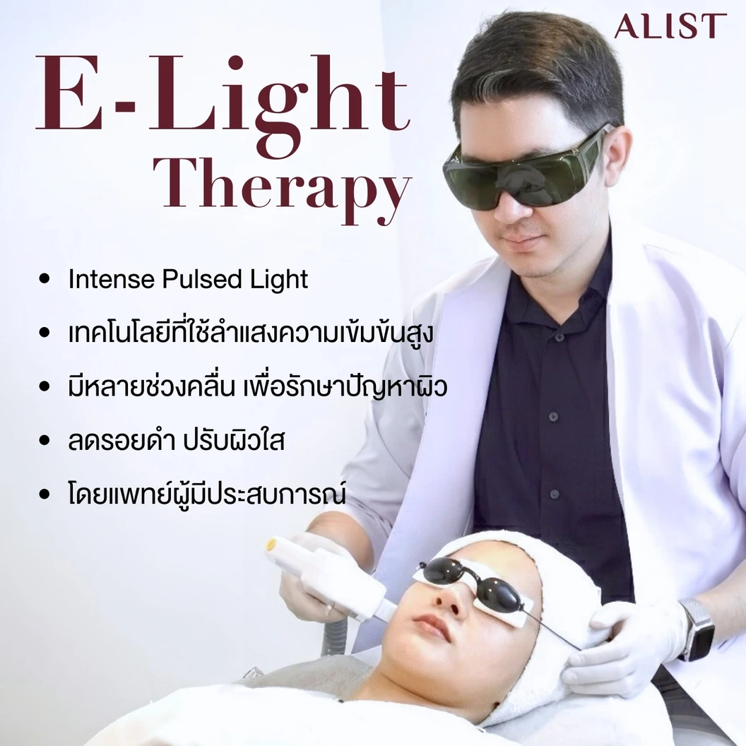 โปรแกรมลดรอยสิวหน้า (E-Light Program) 6 ขั้นตอน