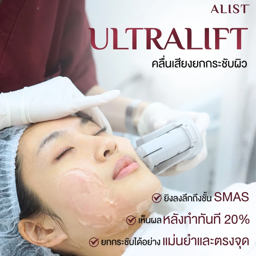 โปรแกรม Ultra Lift 100 ช็อต (หน้า)