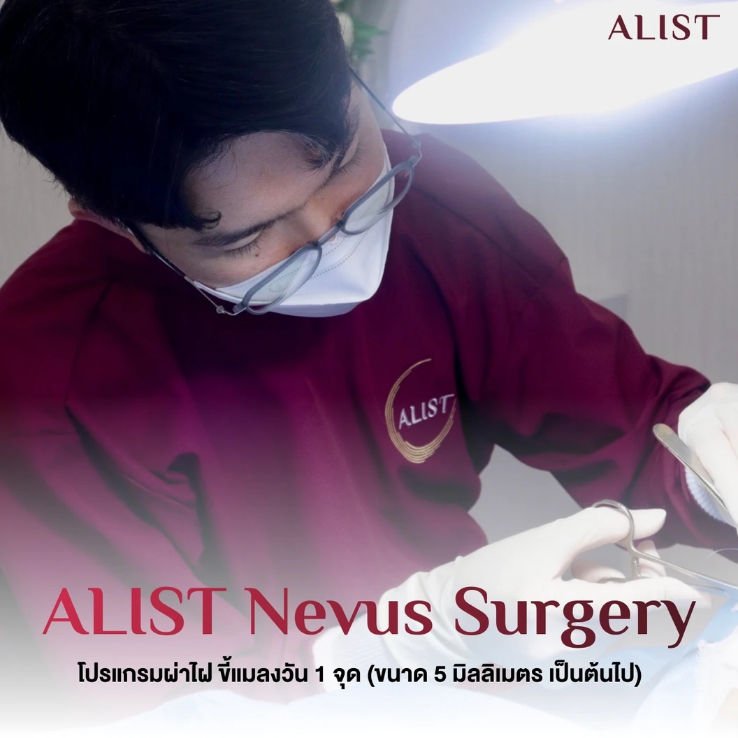 โปรแกรมผ่าไฝ ขี้แมลงวัน (ALIST Nevus Surgery) 1 จุด ขนาด 5 มม. ขึ้นไป
