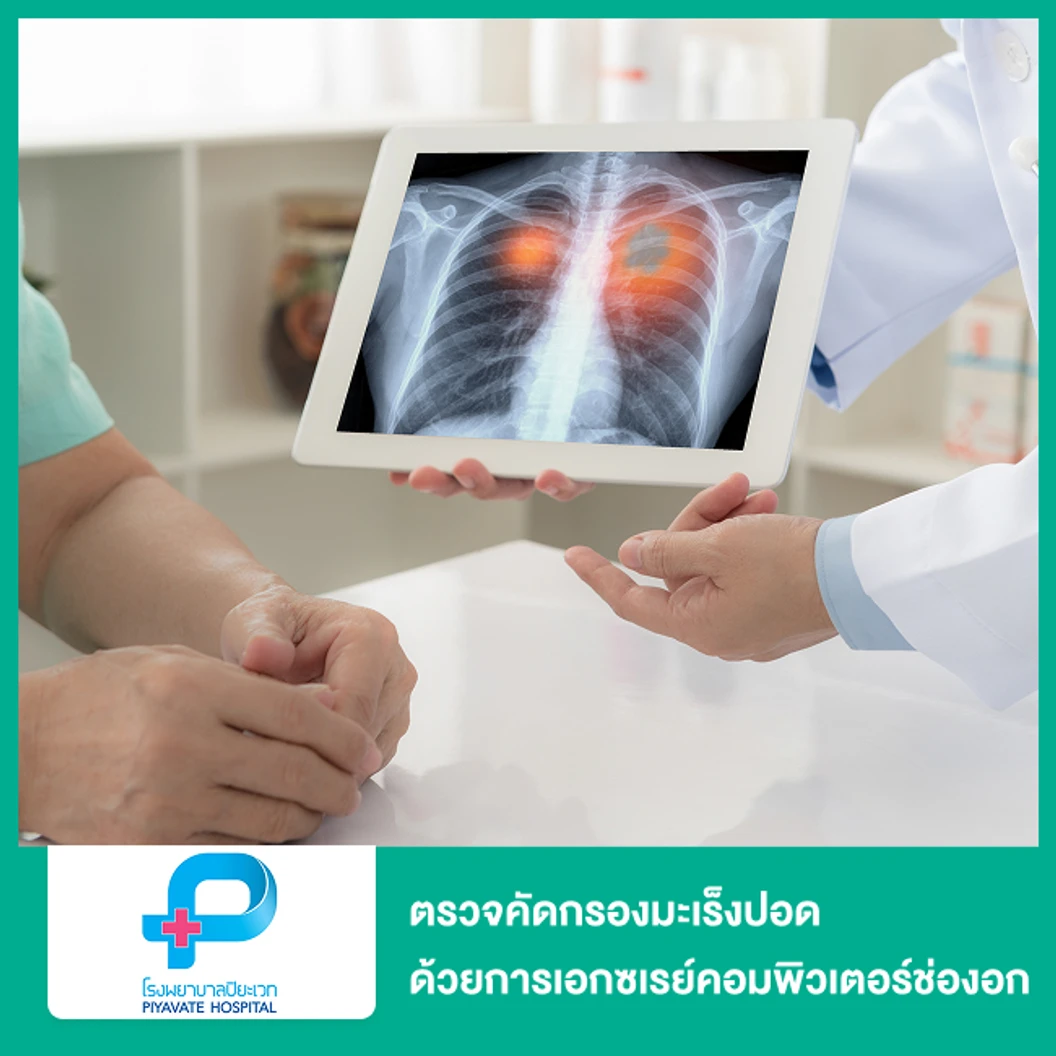 ตรวจคัดกรองมะเร็งปอด ด้วยการเอกซเรย์คอมพิวเตอร์ช่องอก แบบใช้รังสีต่ำ (CT Low Dose)