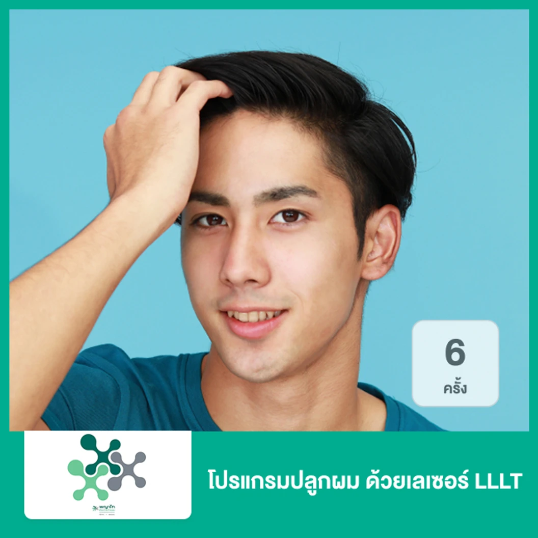 โปรแกรมปลูกผม ด้วยเลเซอร์ LLLT 6 ครั้ง