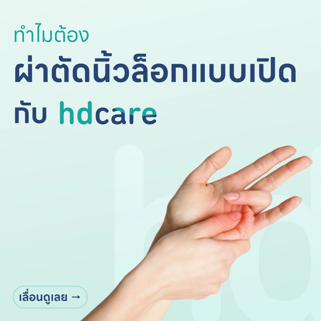 ผ่าตัดนิ้วล็อค