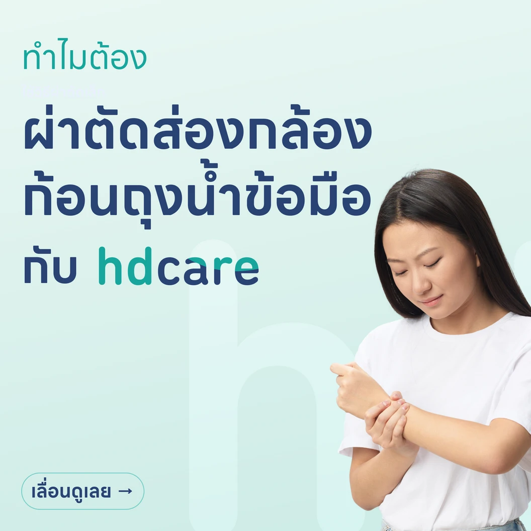 ผ่าตัดส่องกล้องก้อนถุงน้ำข้อมือ