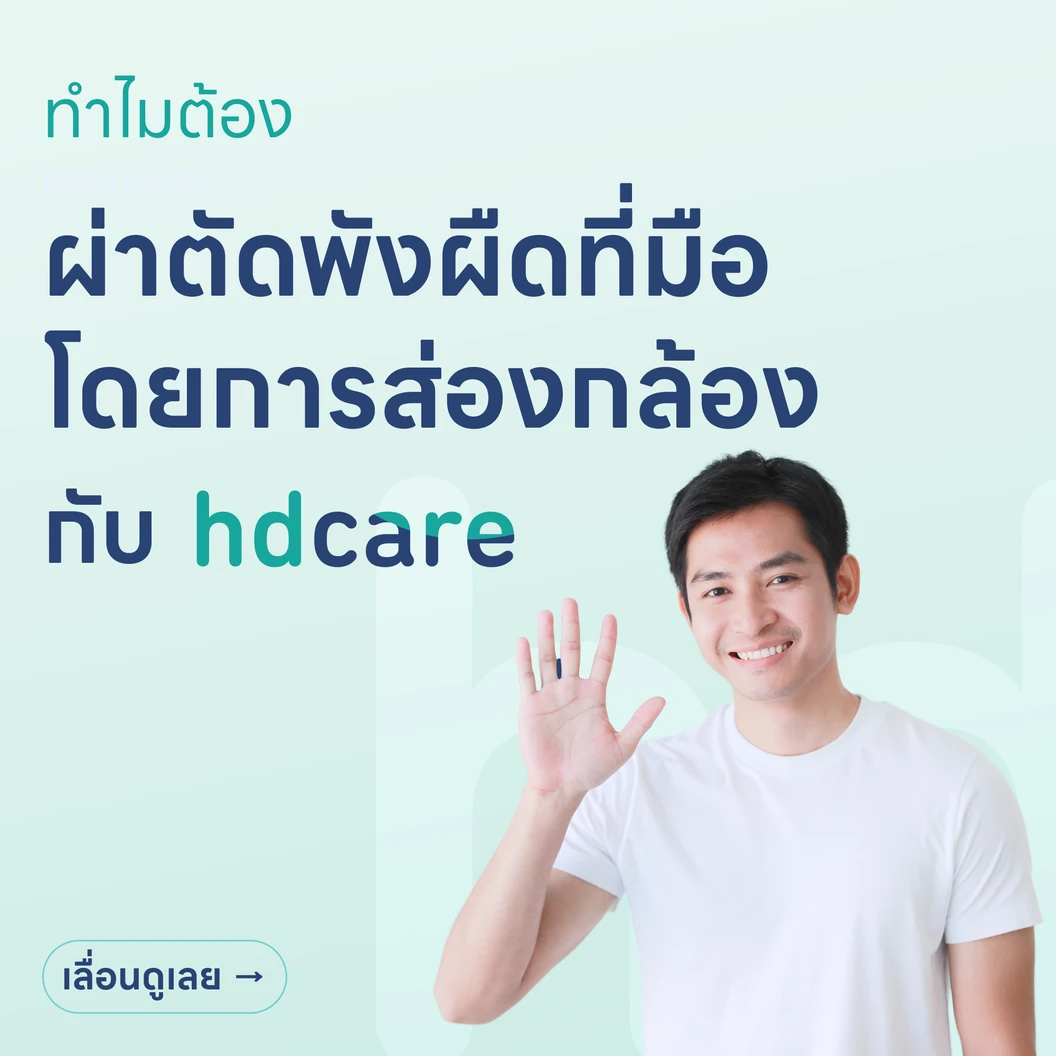 ผ่าตัดพังผืดที่มือโดยการส่องกล้อง