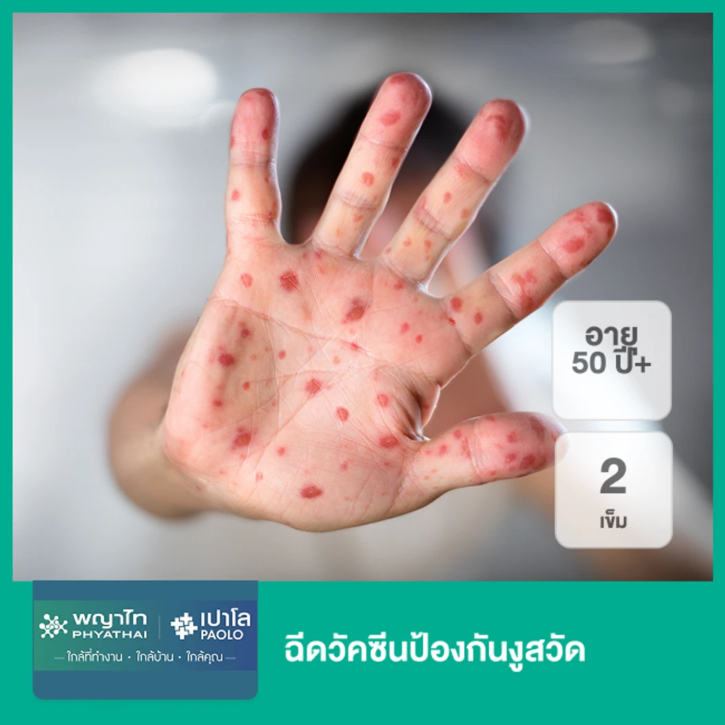 ฉีดวัคซีนป้องกันงูสวัด 2 เข็ม (50 ปีขึ้นไป)