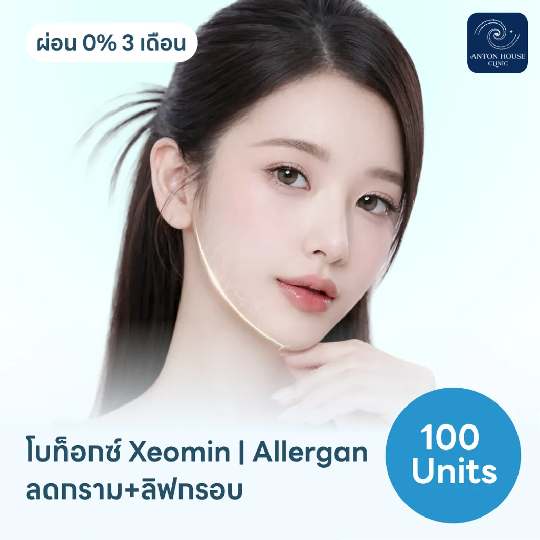 โปรแกรมฉีดโบท็อกซ์เยอรมัน/อเมริกา Xeomin/Allergan 100 ยูนิต ฟรี! เมโสแฟต 10 ซีซี