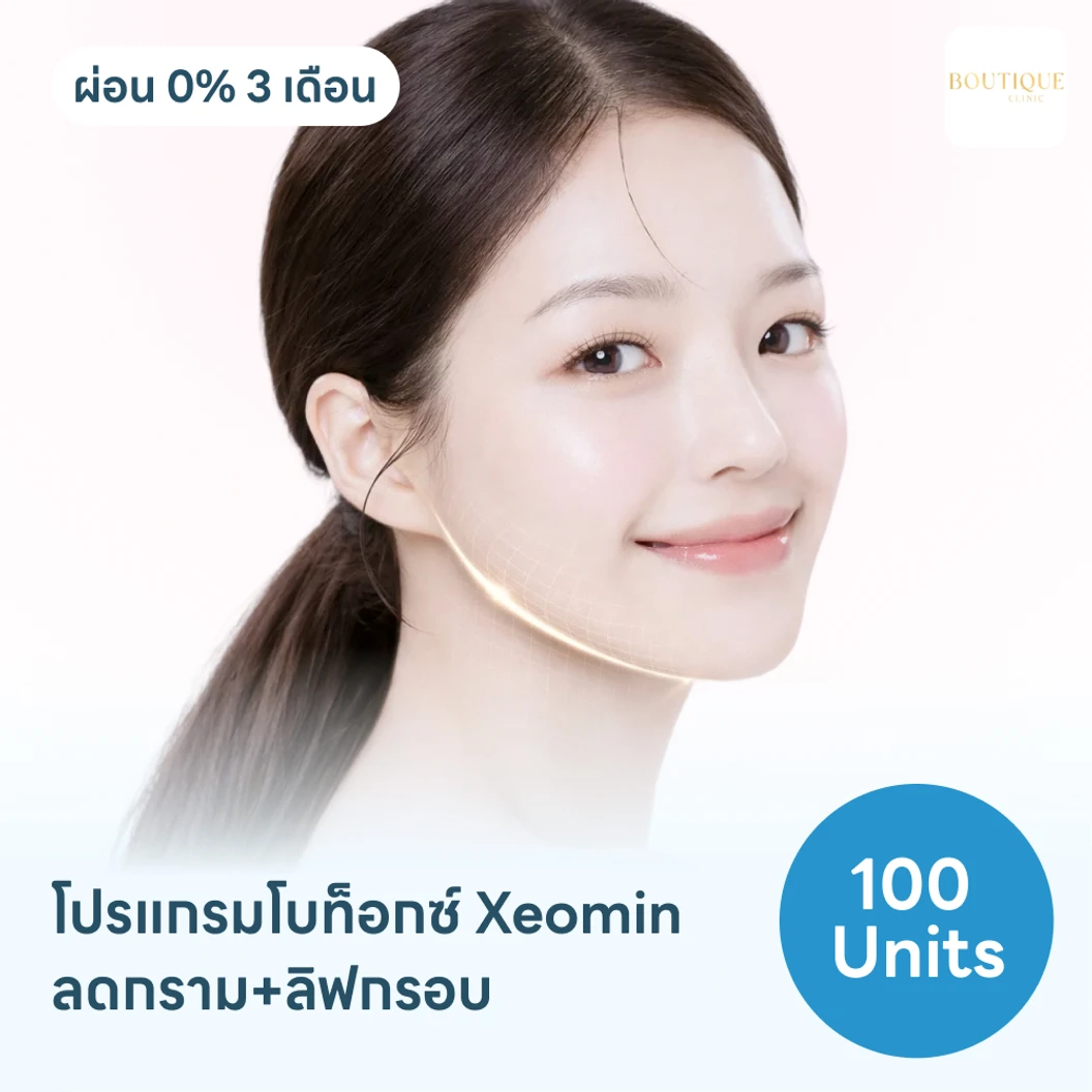 โปรแกรมฉีดโบท็อกซ์เยอรมัน Xeomin 100 ยูนิต ฟรี! เมโสแฟต 10 ซีซี