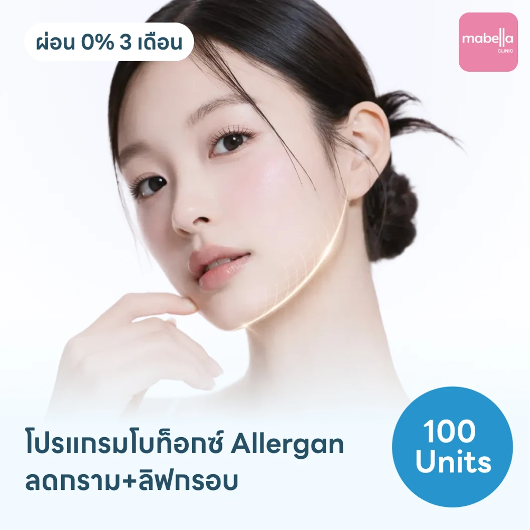โปรแกรมฉีดโบท็อกซ์อเมริกา Allergan 100 ยูนิต ย้ำฟรี! 1 ครั้ง