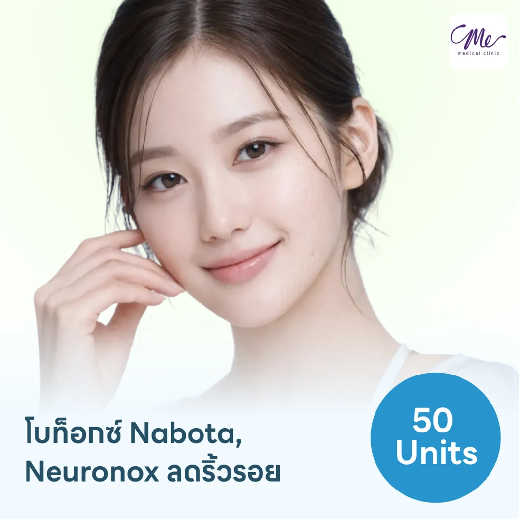 โปรแกรมฉีดโบท็อกซ์เกาหลี Nabota/Neuronox 50 ยูนิต