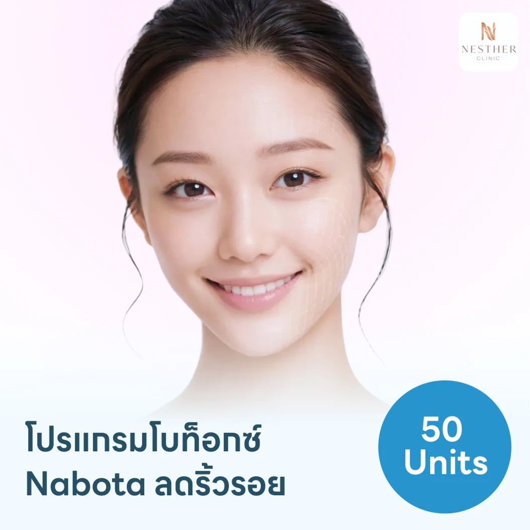 โปรแกรมฉีดโบท็อกซ์เกาหลี Nabota 50 ยูนิต