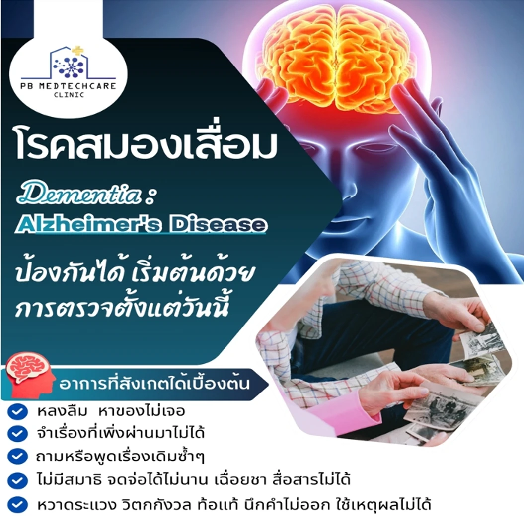 ตรวจคัดกรองโรคสมองเสื่อม (Dementia) และโรคอัลไซเมอร์ (Alzheimer)