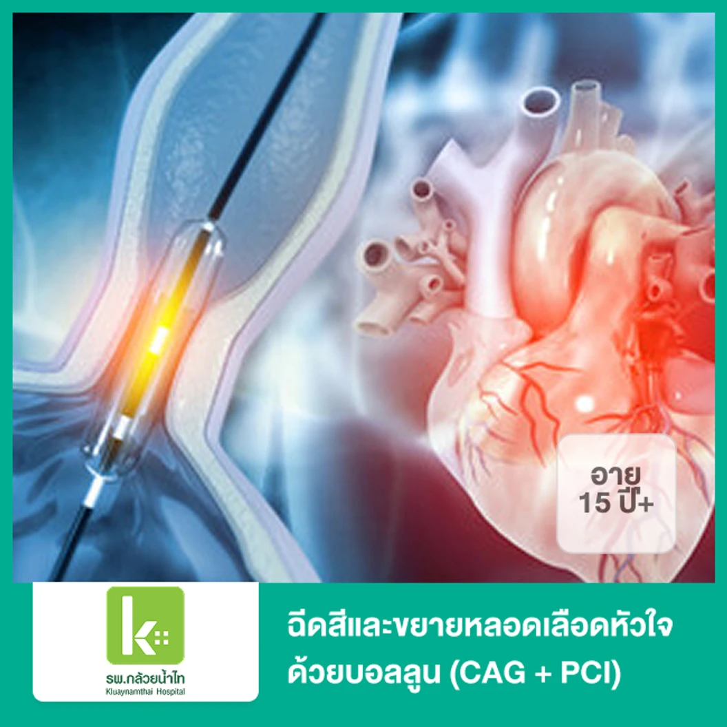 ฉีดสีและขยายหลอดเลือดหัวใจ ด้วยบอลลูน (CAG + PCI) นอนพักที่ รพ. 2 วัน 1 คืน (15 ปีขึ้นไป)