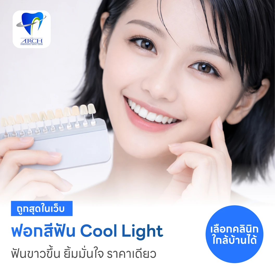 ฟอกสีฟันที่คลินิก ด้วยระบบ Cool Light