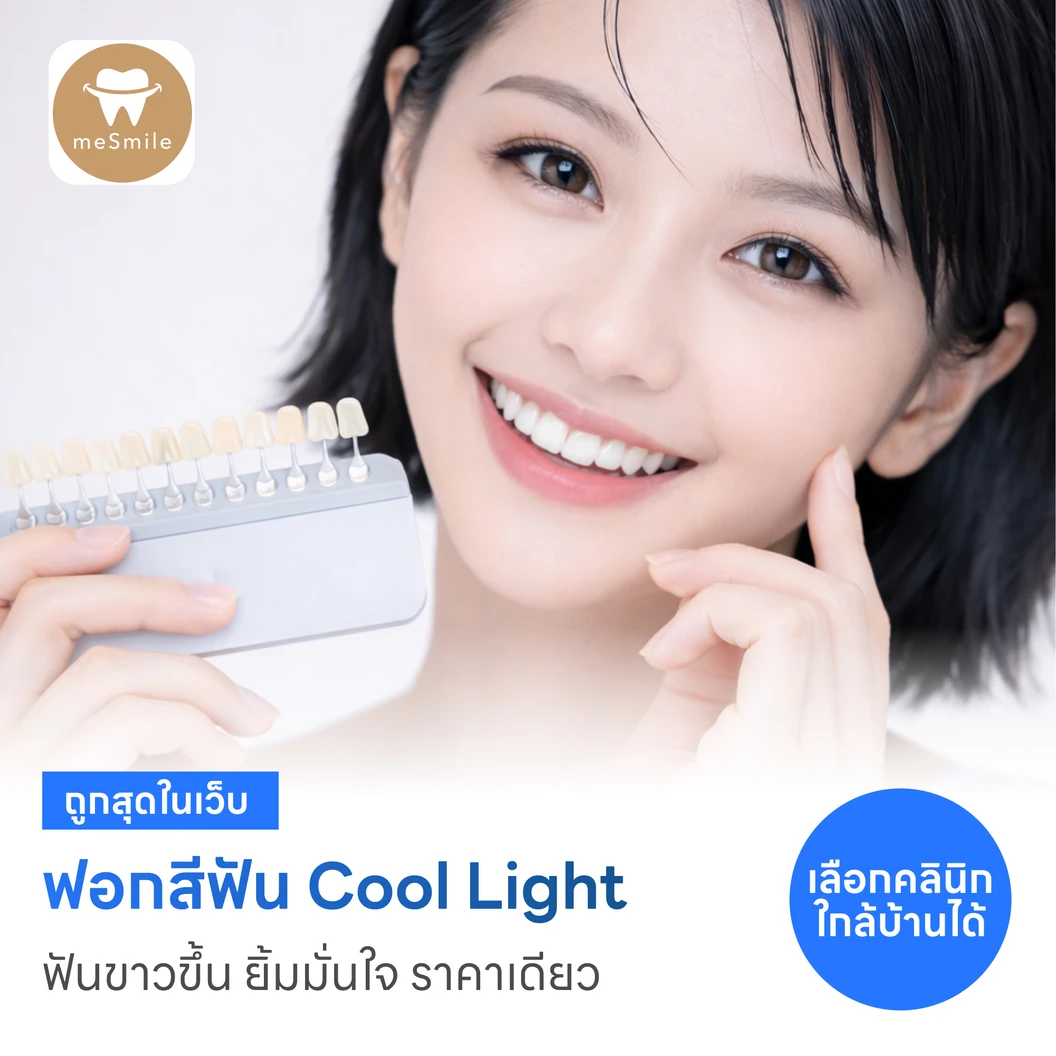 ฟอกสีฟันที่คลินิก ด้วยระบบ Cool Light