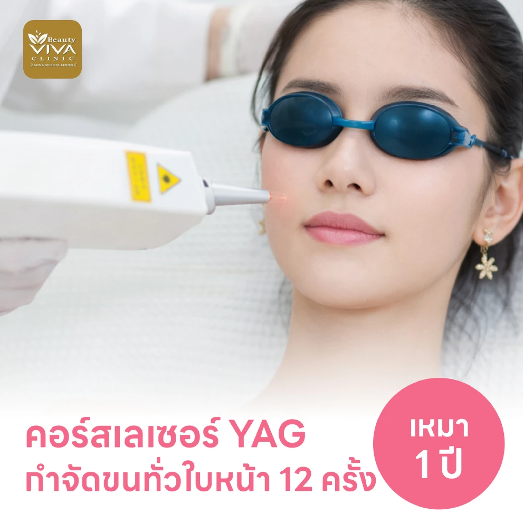 คอร์สเลเซอร์กำจัดขนทั่วหน้า 12 ครั้ง ด้วย YAG Laser