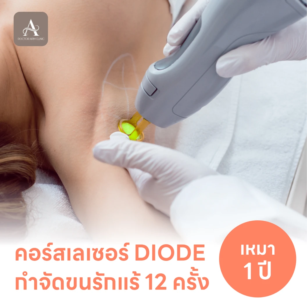 คอร์สเลเซอร์กำจัดขนรักแร้ 12 ครั้ง ด้วย Diode Laser
