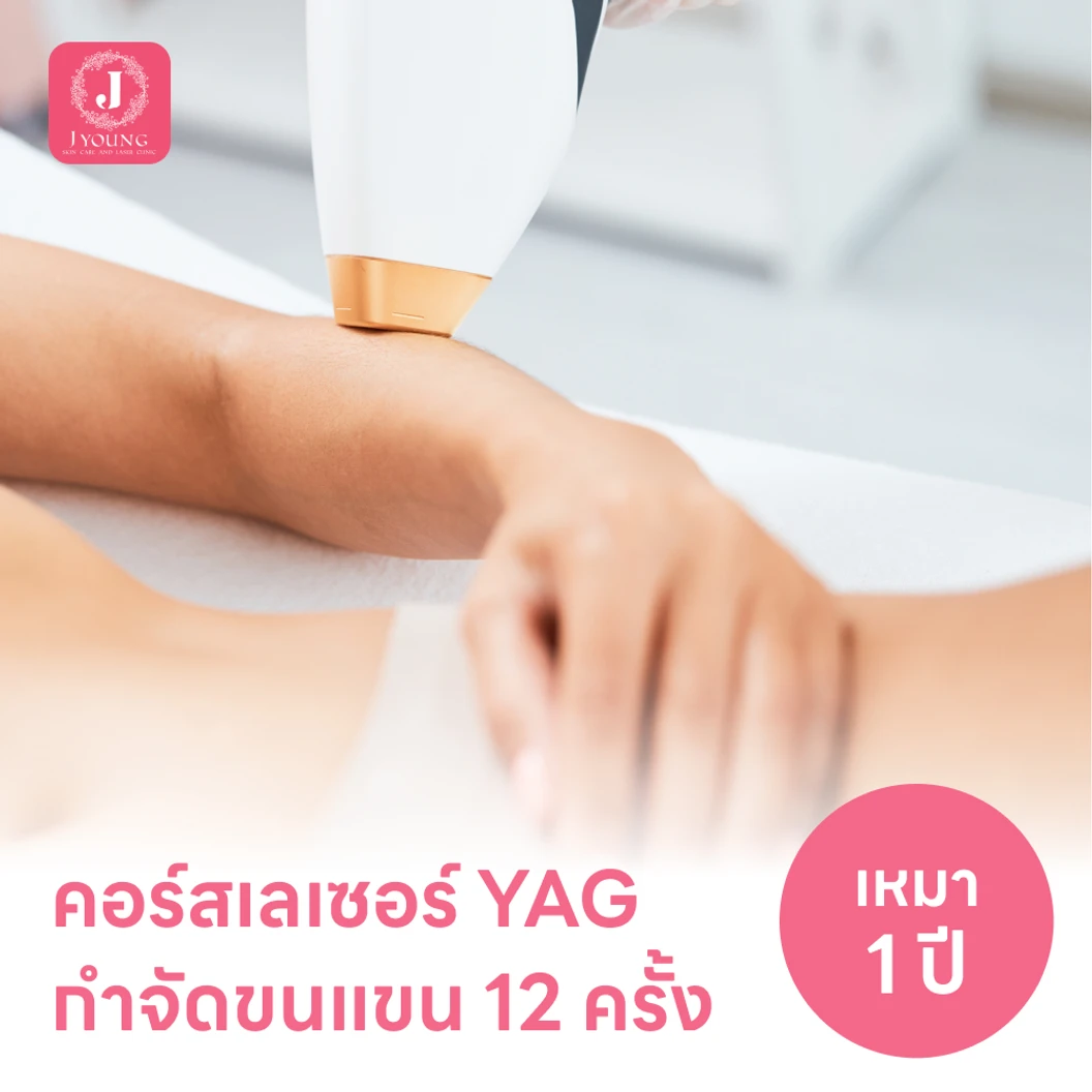 คอร์สเลเซอร์กำจัดขนแขน 12 ครั้ง ด้วย YAG Laser
